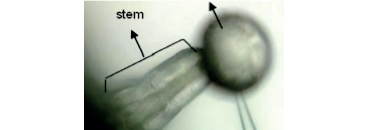 PČR: Obr. 2 – Stonkový kulovitý trichom tvořený hlavičkou a stonkem (11)