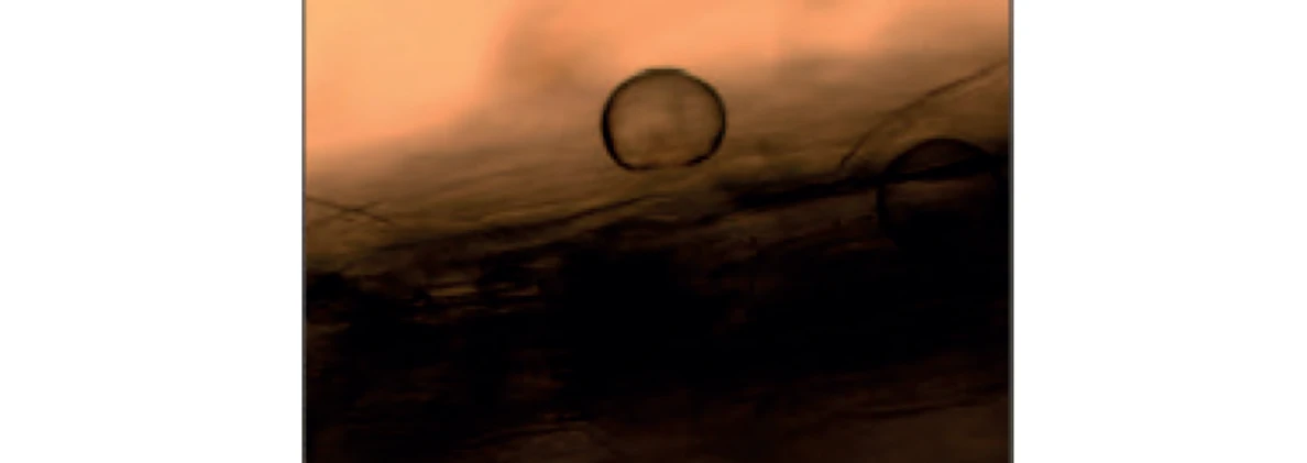 PČR: Obr. 4 – Baňatý trichom (11)