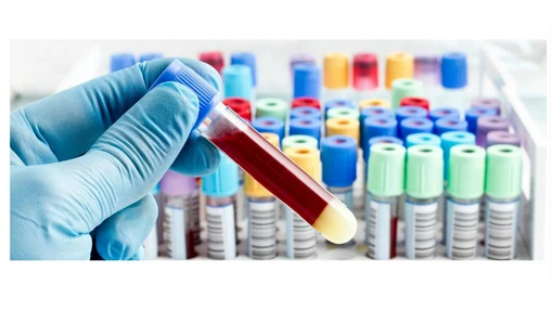 Použití vodíku jako nosného plynu pro GC/MS/MS analýzu steroidů v moči za méně než 10 minut