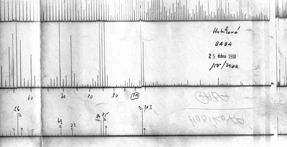 ČSHS: Obrázek 1:  Dobový záznam hmotnostního spektra na uv-citlivý papír