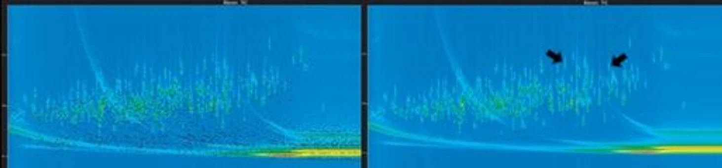 LECO Identification Grading System: Vlevo: Počáteční HRD (n = 4800); Vpravo: IGS > 2 (n = 245).