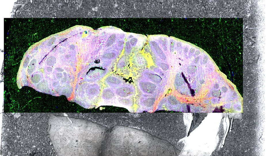 Optik Instruments: FTIR a Ramanova mikroskopie - Pokročilé možnosti akvizice a interpretace dat: Obr. 2 – Infračervená chemická mapa řezu tkání o rozměrech 14.7 x 5.9 mm. Pomocí klasické FTIR mikroskopie by měření trvalo cca 130 hodin, s FTIR-FPA mikroskopií 113 minut, v případě FTIR-QCL mikroskopie je tato mapa změřena za 8 minut!